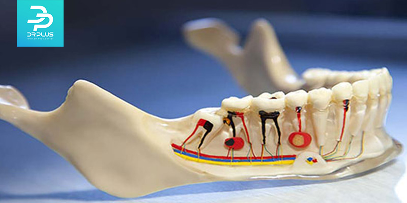 آیا میدانید مراقبت بعد از عصب کشی دندان چگونه است ؟