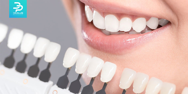 نکات طلایی برای مراقبت از لمینت دندان