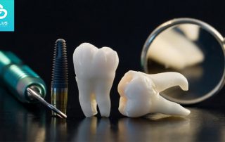 مراقبت بعد از ایمپلنت دندان - باید ها و نبایدهایی که باید بدانید