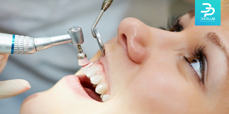 مراقبت بعد جرمگیری دندان شامل چه نکاتی است