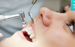 مراقبت بعد جرمگیری دندان شامل چه نکاتی است
